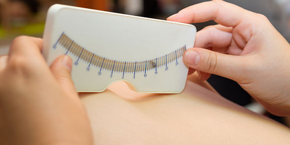 scoliosis treatment in Campbell